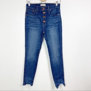 Madewell 10" High-Rise Skinny Jeans: Chewed-Hem